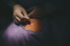 Νέα ενδοσκοπική θεραπεία με LASER – Τέλος στην Κύστη Κόκκυγος