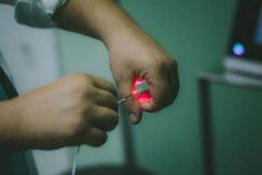 Νέα ενδοσκοπική θεραπεία με LASER – Τέλος στην Κύστη Κόκκυγος